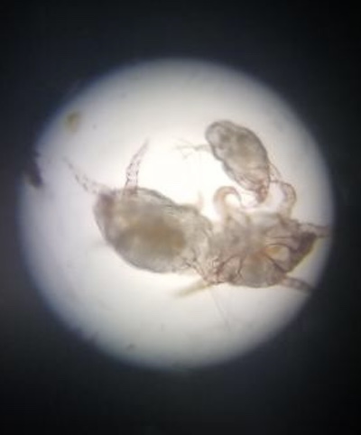 Ear Mite under Microscope